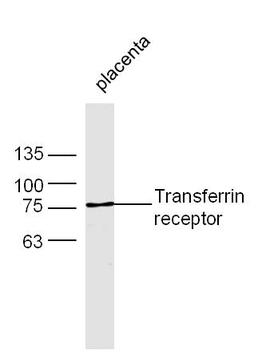 TFRC Rabbit Polyclonal Antibody