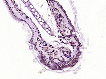 FOXN1 Rabbit Polyclonal Antibody