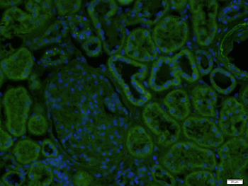Beta Defensin 3 Rabbit Polyclonal Antibody (FITC)