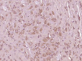 D4S234E Rabbit Polyclonal Antibody