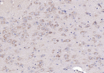 D4S234E Rabbit Polyclonal Antibody