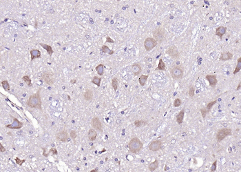 D4S234E Rabbit Polyclonal Antibody