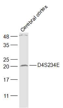 D4S234E Rabbit Polyclonal Antibody