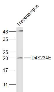 D4S234E Rabbit Polyclonal Antibody