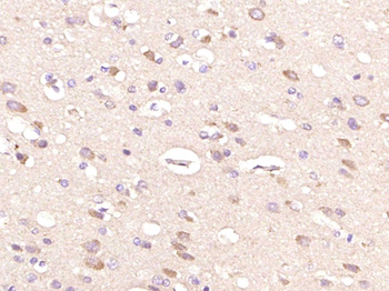 Phospho-Tau (Thr181) Rabbit Polyclonal Antibody