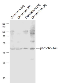 Phospho-Tau (Thr181) Rabbit Polyclonal Antibody