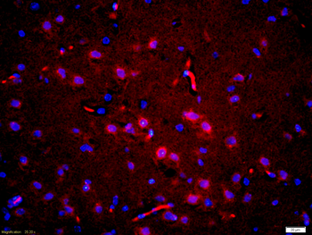 Phospho-Tau (Thr181) Rabbit Polyclonal Antibody