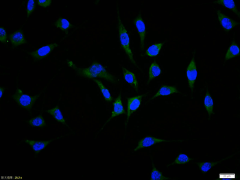 Phospho-Tau (Thr181) Rabbit Polyclonal Antibody