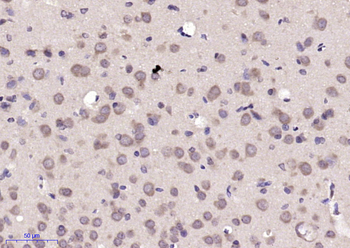 CNOT8 Rabbit Polyclonal Antibody