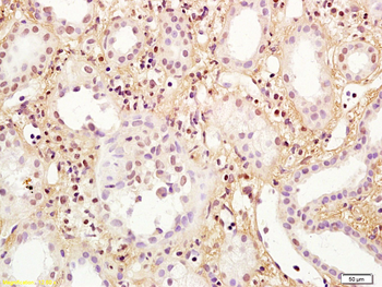 RING2 Rabbit Polyclonal Antibody