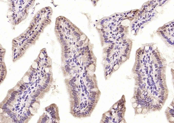 MLF1/MLF2 Rabbit Polyclonal Antibody