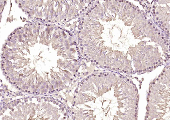 MLF1/MLF2 Rabbit Polyclonal Antibody