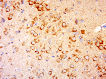 TYW5 Rabbit Polyclonal Antibody