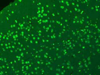 SIP1 Rabbit Polyclonal Antibody