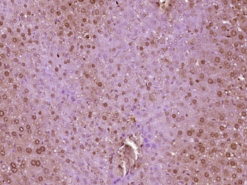 SIP1 Rabbit Polyclonal Antibody
