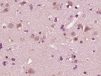 Phospho-STMN1 (Ser63) Rabbit Polyclonal Antibody