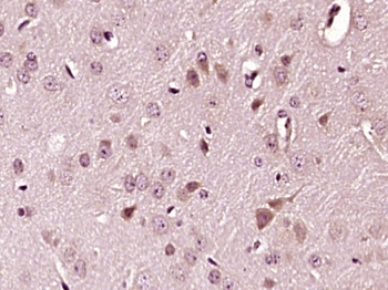 Phospho-STMN1 (Ser63) Rabbit Polyclonal Antibody