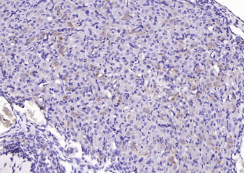 Phospho-STMN1 (Ser63) Rabbit Polyclonal Antibody