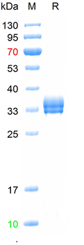 Recombinant human FCER2/CD23 protein,N-His-Avi (HEK293)