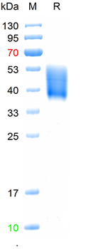 Recombinant human Fc gamma RIIIA/CD16a (V176) Protein, C-His(HEK293)