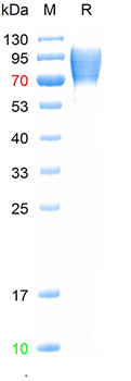 Recombinant human HAVCR1 protein, N-His (HEK293)