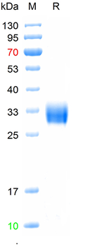 Recombinant Human Fc gamma RIIA/CD32a (R167), His-Avi (HEK293)