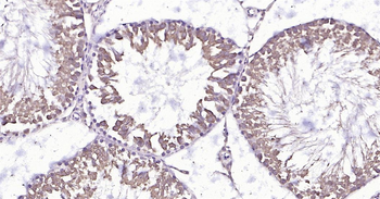 Rat HSC70 Ready-To-Use IHC Kit