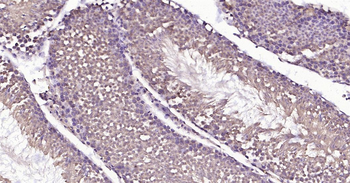 Mouse HSC70 Ready-To-Use IHC Kit