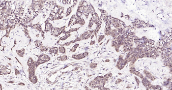 Human HSC70 Ready-To-Use IHC Kit