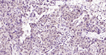 HSC70 Ready-To-Use IHC Kit