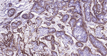 Human Integrin alpha 2 Ready-To-Use IHC Kit