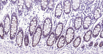 Human Integrin alpha 2 Ready-To-Use IHC Kit