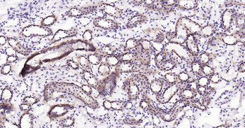 Integrin alpha 2 Ready-To-Use IHC Kit