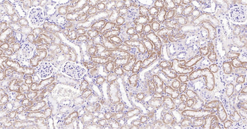 Integrin alpha 2 Ready-To-Use IHC Kit