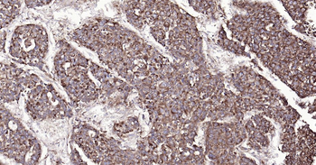 SYVN1 Ready-To-Use IHC Kit
