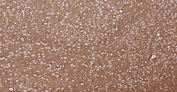 Rat TUBB3 Ready-To-Use IHC Kit