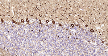 TUBB3 Ready-To-Use IHC Kit