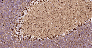 TUBB3 Ready-To-Use IHC Kit