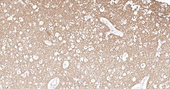 SYP Ready-To-Use IHC Kit