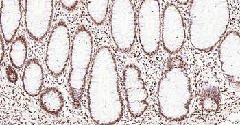 Human ERCC1 Ready-To-Use IHC Kit