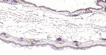 Mouse pan CK Ready-To-Use IHC Kit
