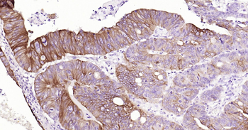 Human CK20 Ready-To-Use IHC Kit