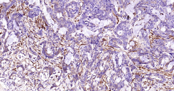 Human CALB2 Ready-To-Use IHC Kit