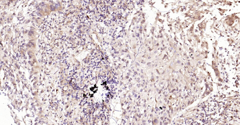 CALB2 Ready-To-Use IHC Kit