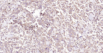 CALB2 Ready-To-Use IHC Kit