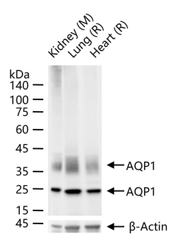 AQP1 Recombinant Rabbit Monoclonal Antibody