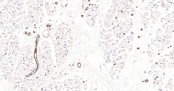AQP1 Recombinant Rabbit Monoclonal Antibody