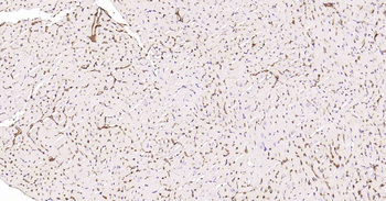 AQP1 Recombinant Rabbit Monoclonal Antibody