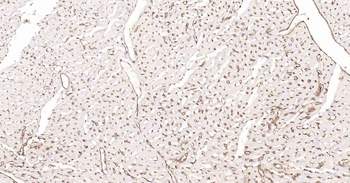 AQP1 Recombinant Rabbit Monoclonal Antibody