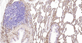 AQP1 Recombinant Rabbit Monoclonal Antibody